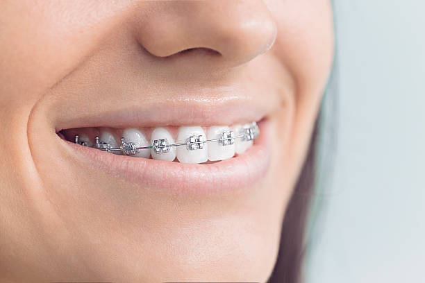 Best Wisdom Tooth Removal  in Dania Beach, FL